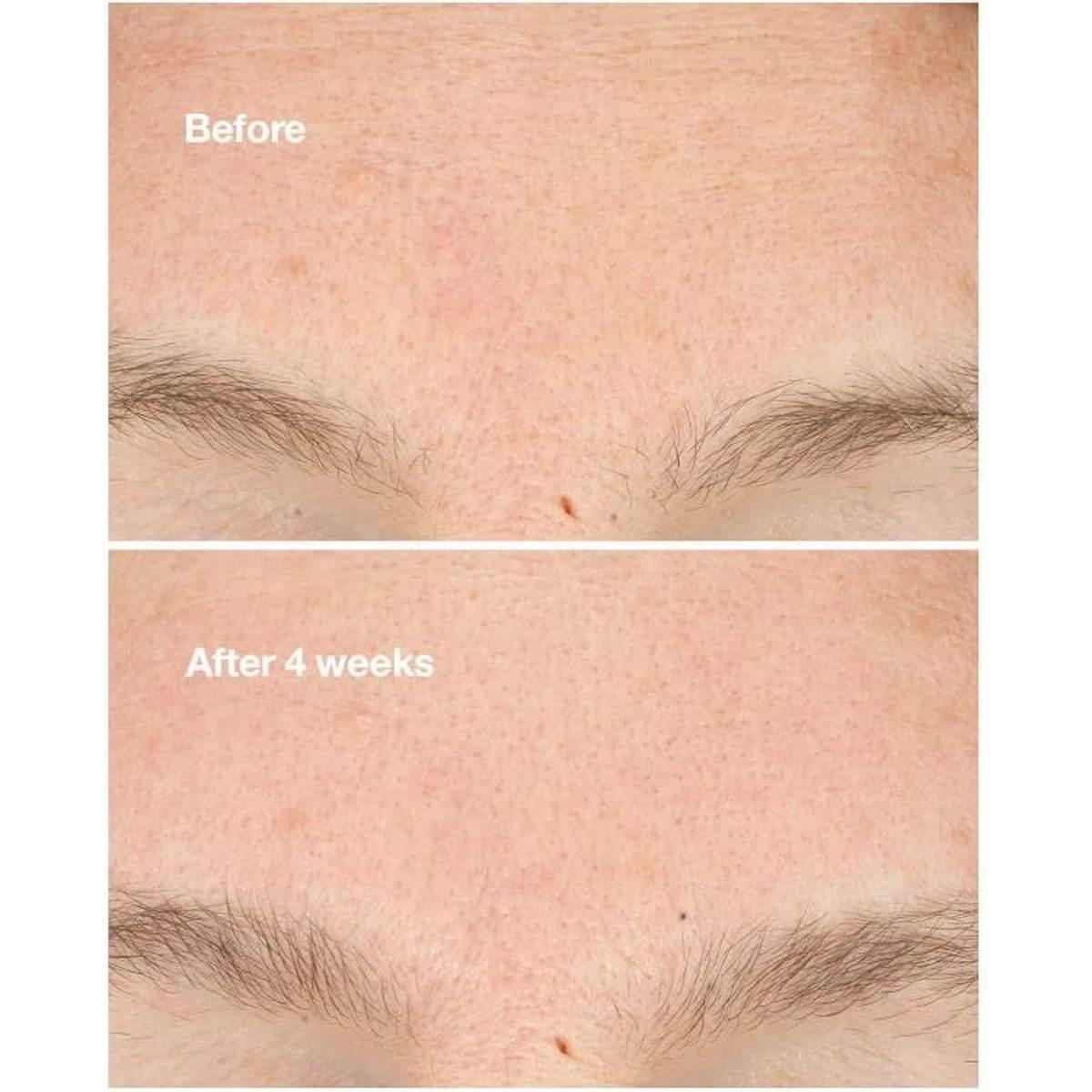 Clarifying do-over peel 30ml